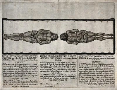 The Shroud of Turin: an unexplained artifact